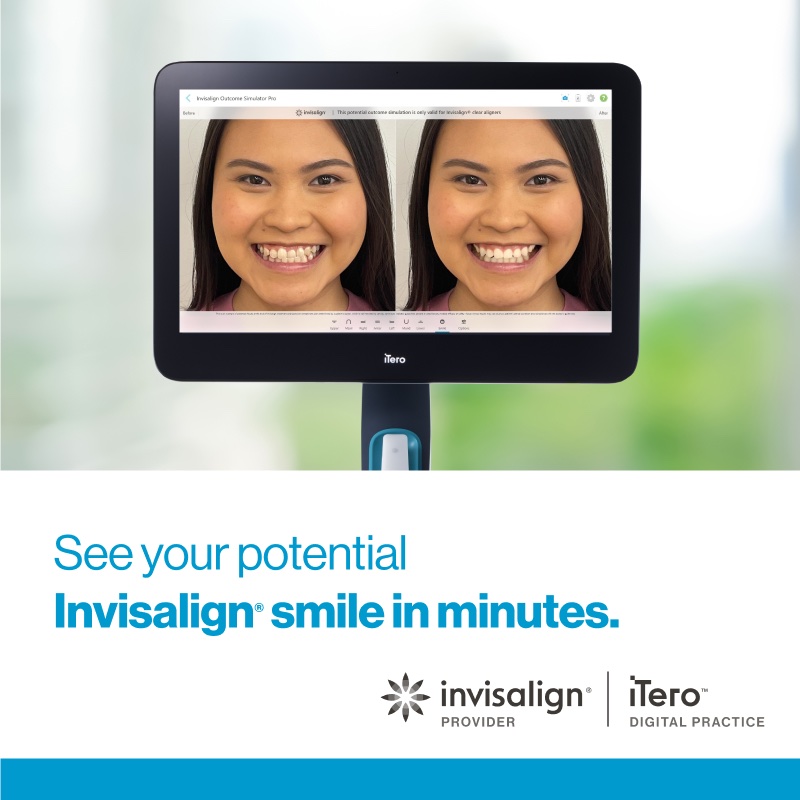 iTero scanner screen showing an Invisalign Outcome Simulator Pro before-and-after smile preview. See your potential Invisalign smile in minutes. Invisalign Provider, iTero Digital Practice.