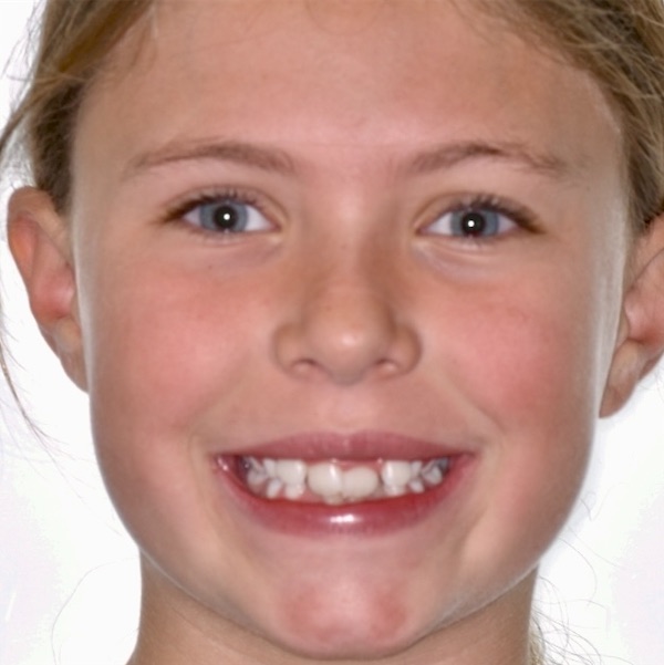 Patient's smile before treatment