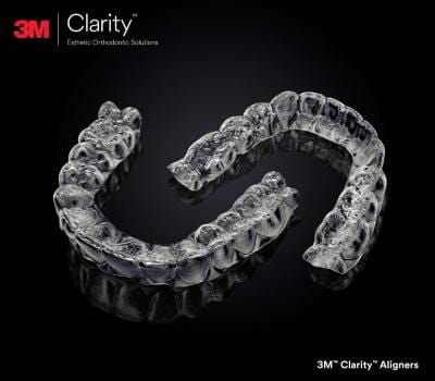 Miller Orthodontics clear braces / aligners, youth and kids orthodontics, 3M™ Clarity™ Aligners